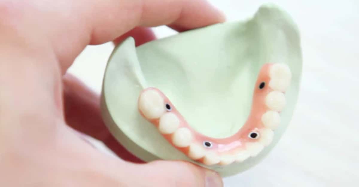 Find Cheap Dental Implants In 2020